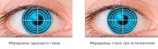 І в порівнянні з лінзами, контактні дарують величезні переваги в носінні
